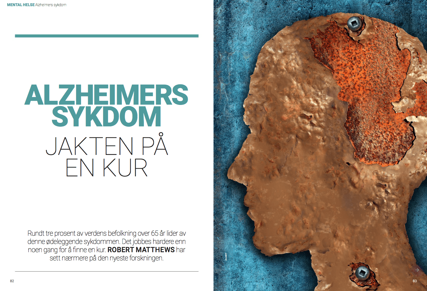 Alzheimer: Jakten på en kur, oppslag