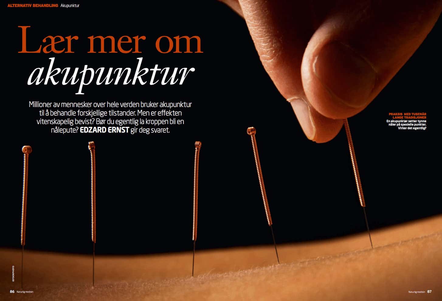 Lær mer om akupunktur, oppslag